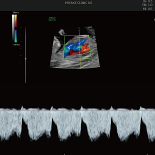 胎児ドックの様子_初期