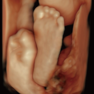 胎児ドックの様子_後期_足